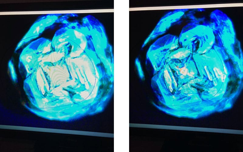 Lab grown diamond exposed to high energy short wave ultraviolet light exhibited the standard reaction of HPHT grown diamonds.  Very strong fluorescence (left) and phosphorescence (right).